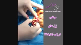 فیلم عوارض ژل های ارزان قیمت