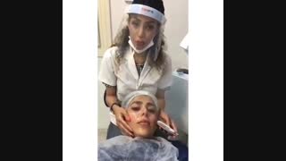 از بین بردن جوش‌های آزار دهنده