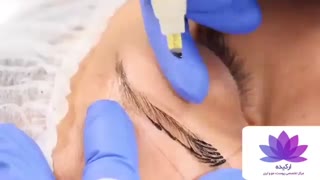 میکرو بلیدینگ