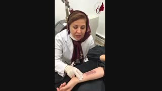 فیلم درمان های ترکیبی اختصاصی در مشکلات پوستی - پارت 1