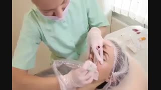 آموزش میکروپیگمنتیشن لب