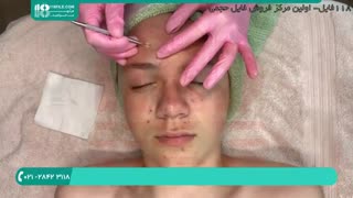 آموزش رفع جوش و لکه های پوستی به روشی ساده عمل زیبایی