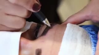 روش جدید کاشت ابرو در ایران
