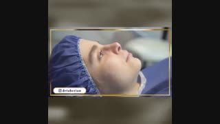 فیلم جراحی بینی ترمیمی