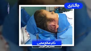 جراحی میکروشی (جراحی زیبایی گوش)