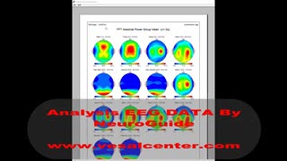تحلیل آماری امواج مغزی با استفاده از نوروگاید