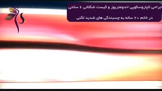 جراحی کیست شکلاتی شش سانتی