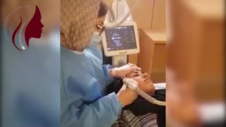 فیلم موارد بکارگیری آر اف فراکشنال و انواع آن - پارت 1