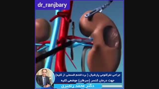 انیمیشن جراحی نفرکتومی پارشیال