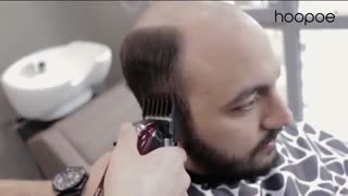 پروتز مو را در هوپو، اولین مرکز زیبایی آقایان تجربه کنید!