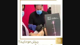 فیلم آیا ریزش مو دارید؟