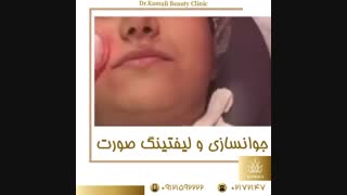 فیلم جوانسازی و لیفتینگ صورت