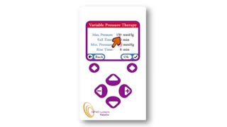 روش درمان با فشار متغیر دستگاه وکیوم تراپی زخم Simplex III