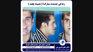 جراحی فک(بایمکس)