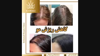 فیلم چگونه 4 ماهه مو دار شویم؟