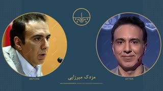 مزدک میرزایی قبل و بعد از کاشت مو در کلینیک دکتر نیلفروش زاده