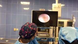 فیلم واقعی جراحی سنگ حالب