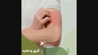نقش تغذیه در درمان آلرژی