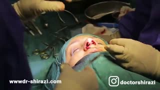 فیلم واقعی عمل بینی