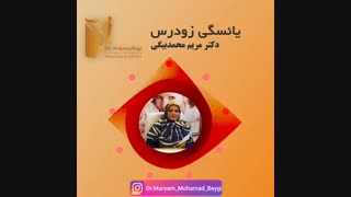 یائسگی زودرس