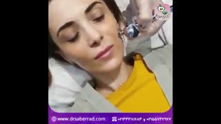 درمااکسی جهت جوانسازی پوست کامپوزیت ونیر