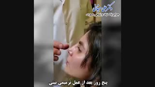 فیلم ترمیم بینی