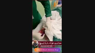 فیلم سزارین بریچ