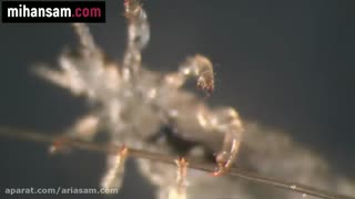 چگونه شپش های سر را از بین ببریم ؟ | شامپو شپش کش قوی