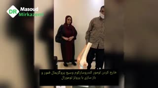 جراحی تومور کندروسارکوم