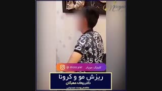 ریزش مو  و کرونا