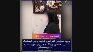 فقر آهن شدید و ریزش مو دندانپزشکی کودکان