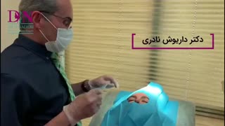 تزریق ژل بهتر است یا بوتاکس؟ بلیچینگ دندان