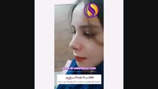 جراحی بینی نیمه فانتزی