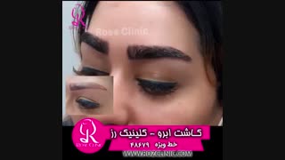 فیلم کاشت ابرو | کلینیک رز | 02148679 | شماره 216