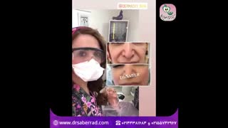 درماالکسی در کلینیک دکتر صابرراد