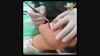 لبخند زیبا برازنده شماست | دکتر حامد صالحی دندانپزشک زیبایی
