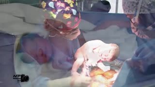 ویدئو جراحی زایمان سزارین