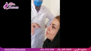 رضایت از عمل بینی