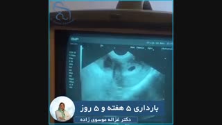 فیلم سونوگرافی بارداری ٥ هفته و ٥ روز توسط دکتر غزاله موسوی زاده