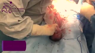 فیلم زایمان سزارین رزا کوچولو بیمارستان تندیس