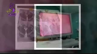 فیلم جراحی لاپاراسکوپی و هیستروسکوپی