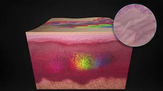 لیزرقلمی نت سل