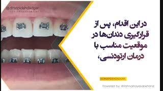 اناملوپلاستی چیست؟ | دکتر سپیده دادگر