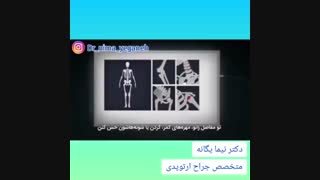 همه چیز درباره آرتروز