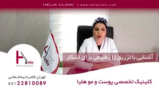 آشنایی با تزریق ژل طبیعی برای اسکار | کلینیک هلیا | 09120687738