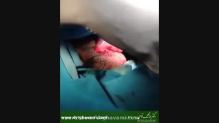 آیا پیچ خوردگی بیضه مردان خطرناک است؟