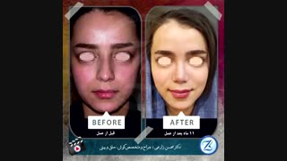 جراحی زیبایی بینی