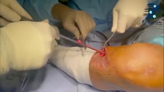 فیلم عمل رباط صلیبی