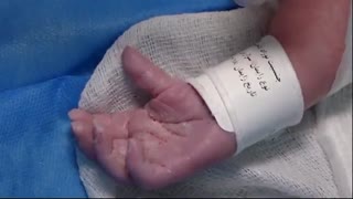 جراحی سزارین در تهران