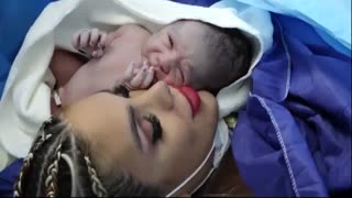 عمل زایمان سزارین توسط دکتر حاجیها